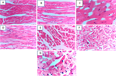 medium/medium-GYA-75-01-e542-gf5.png